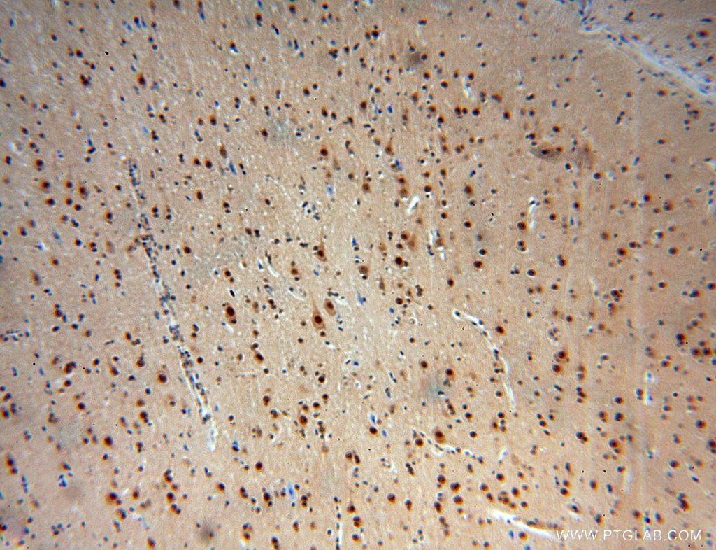 IHC staining of human brain using 17603-1-AP