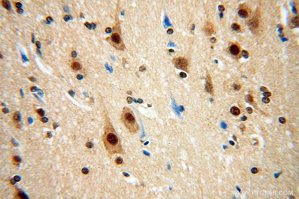 IHC staining of human brain using 17603-1-AP