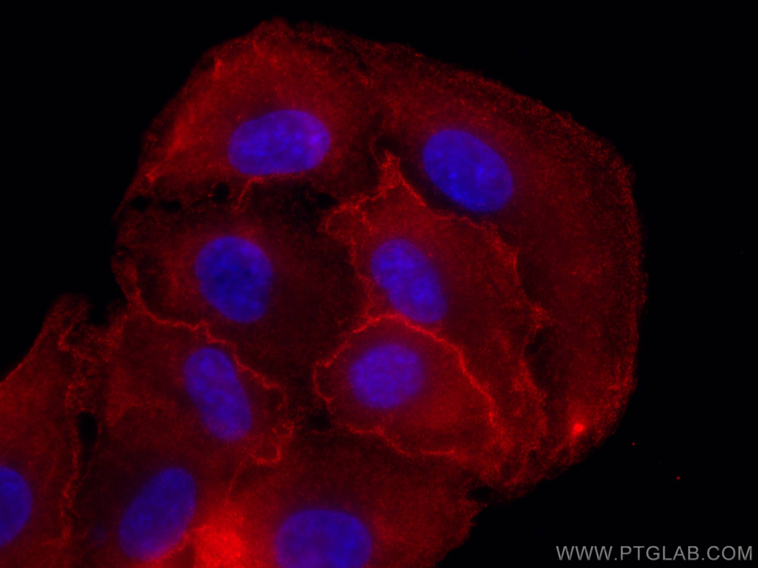 IF Staining of A549 using 66314-1-Ig