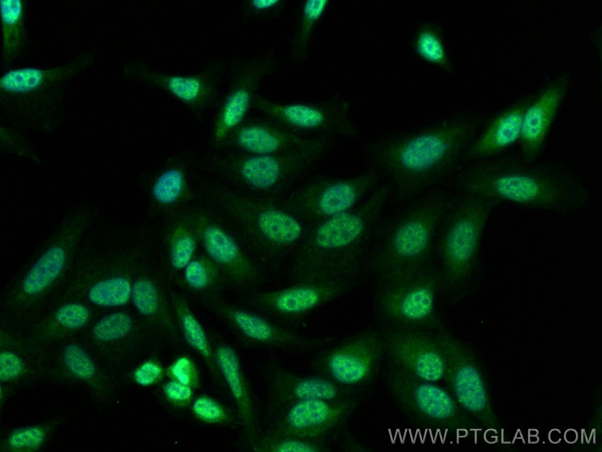 IF Staining of HepG2 using 23826-1-AP