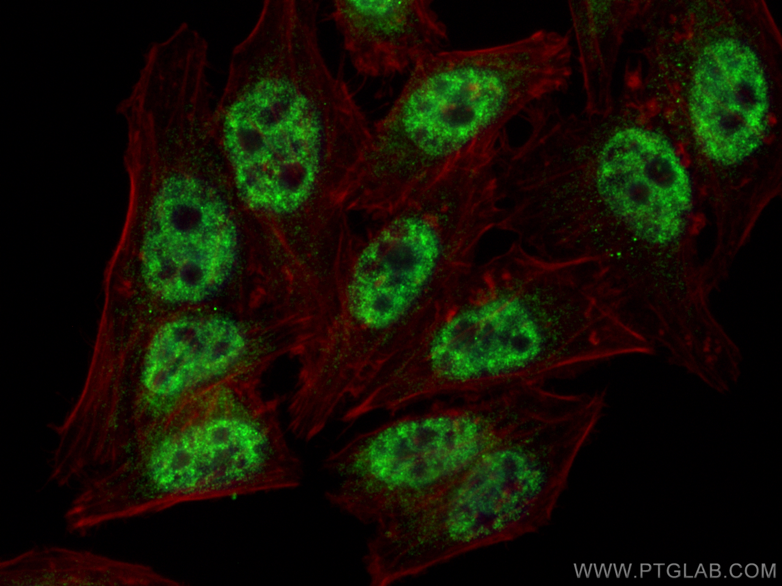 IF Staining of HepG2 using 25337-1-AP