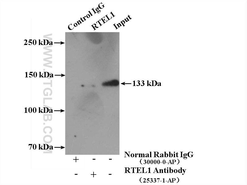 IP experiment of mouse brain using 25337-1-AP