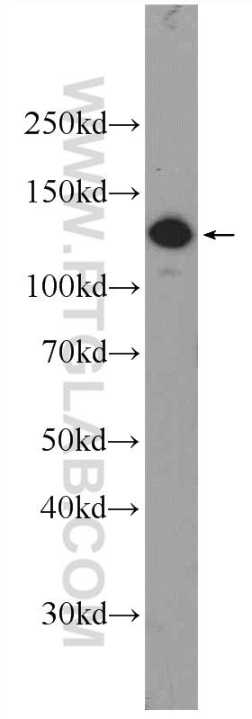 WB analysis of BGC-823 using 25337-1-AP