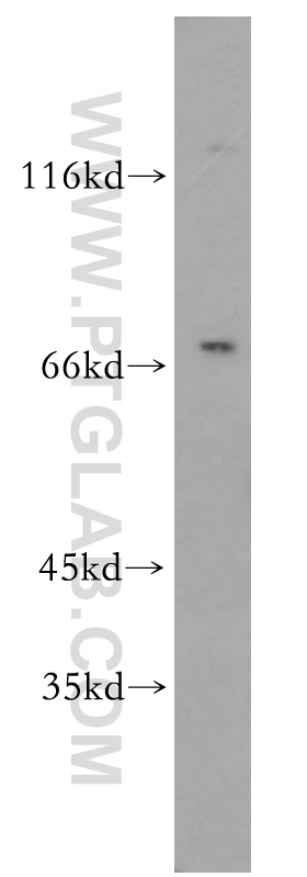 WB analysis of HL-60 using 17458-1-AP