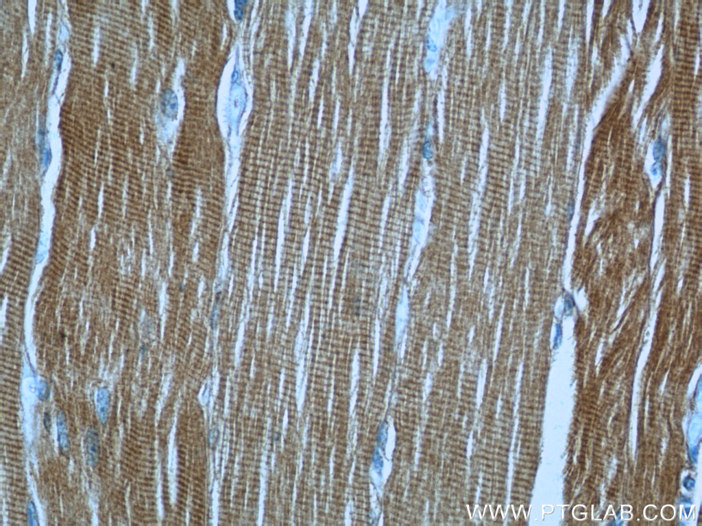 IHC staining of human skeletal muscle using 11168-1-AP