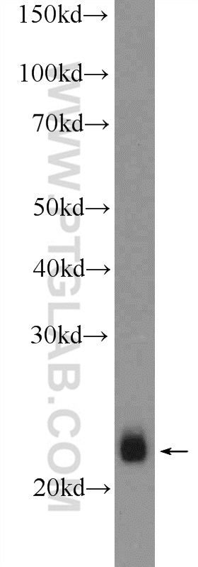 WB analysis of mouse skeletal muscle using 11168-1-AP