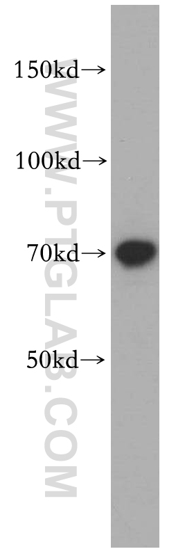 WB analysis of PC-3 using 14137-1-AP