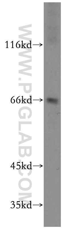 WB analysis of mouse lung using 19180-1-AP