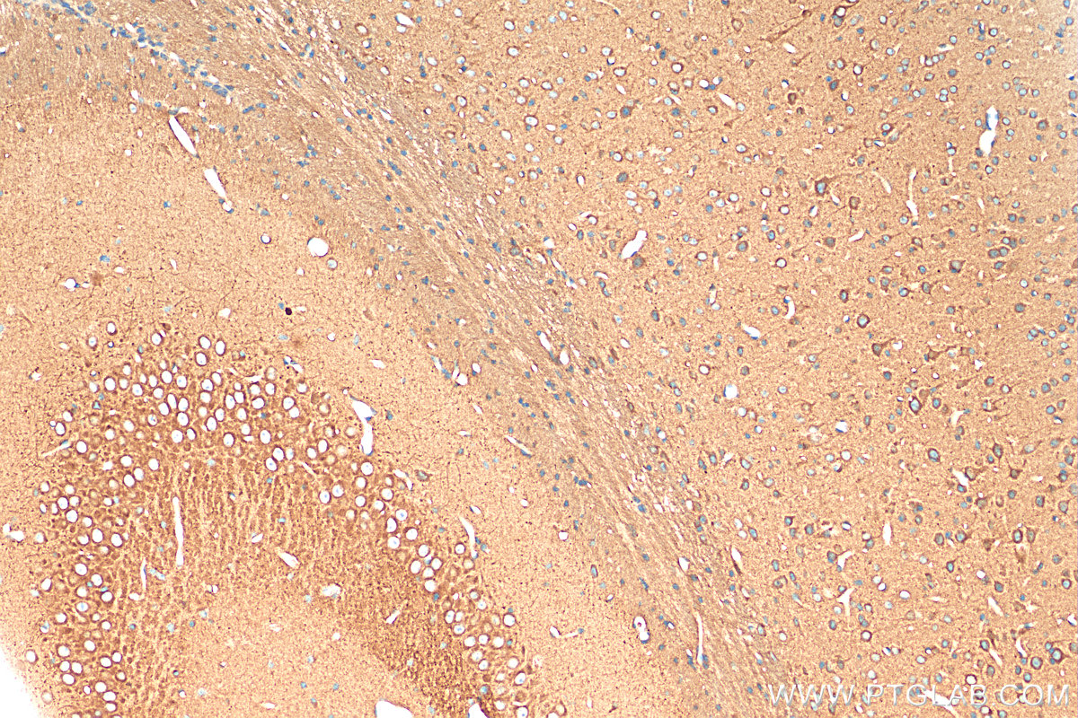 IHC staining of mouse brain using 20531-1-AP