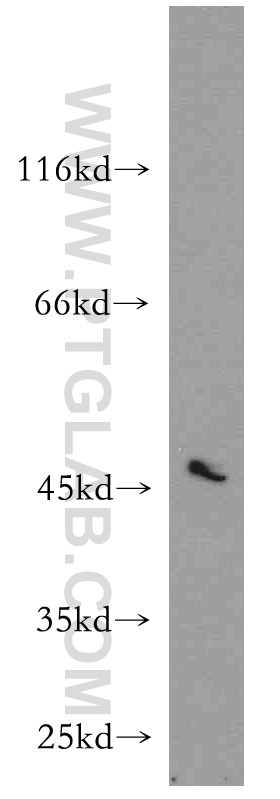 WB analysis of MCF-7 using 17113-1-AP