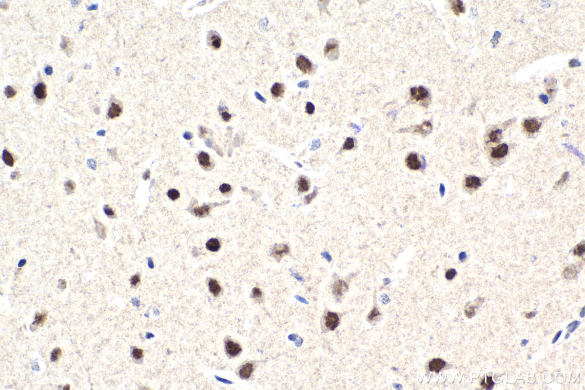 IHC staining of mouse brain using 15494-1-AP