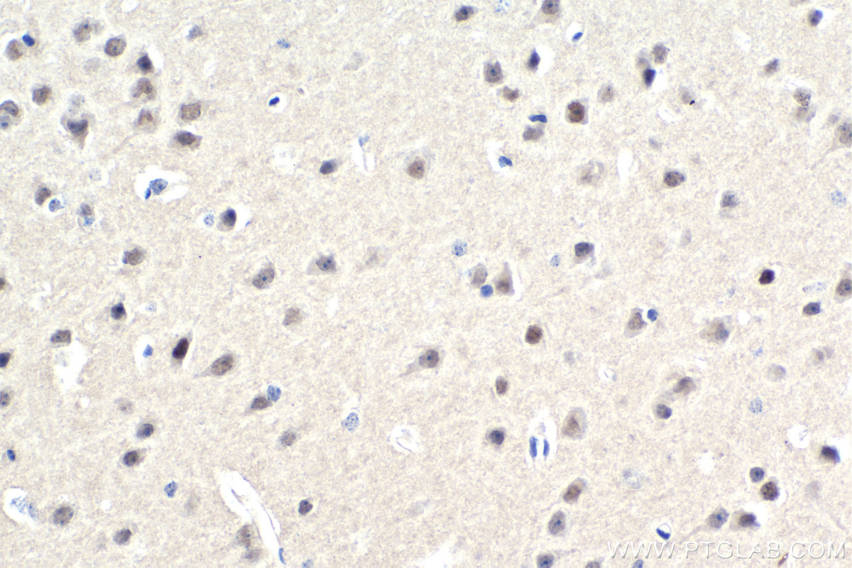 IHC staining of mouse brain using 67086-1-Ig (same clone as 67086-1-PBS)