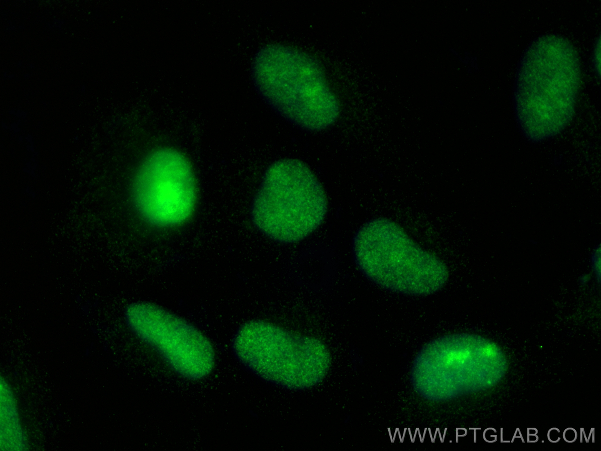 IF Staining of ROS1728 using 20700-1-AP