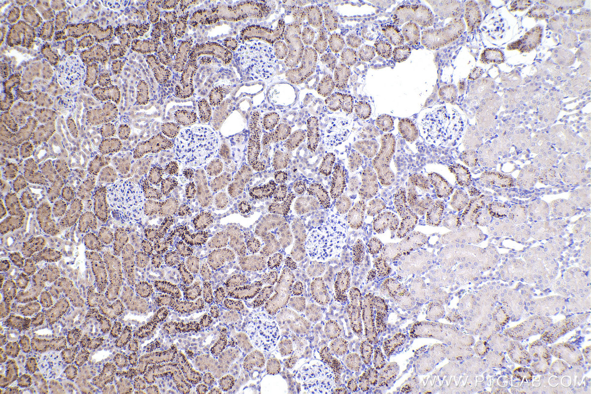 IHC staining of rat kidney using 20700-1-AP