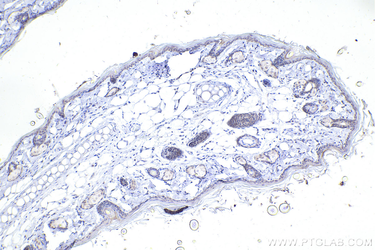 IHC staining of rat skin using 20700-1-AP