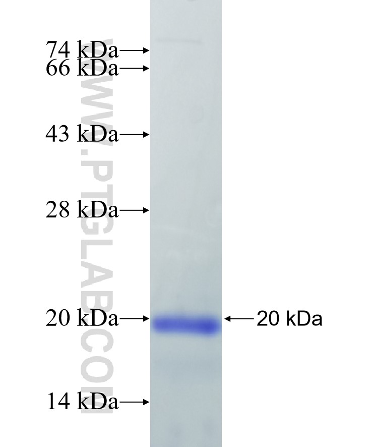 RUNX2 fusion protein Ag28113 SDS-PAGE