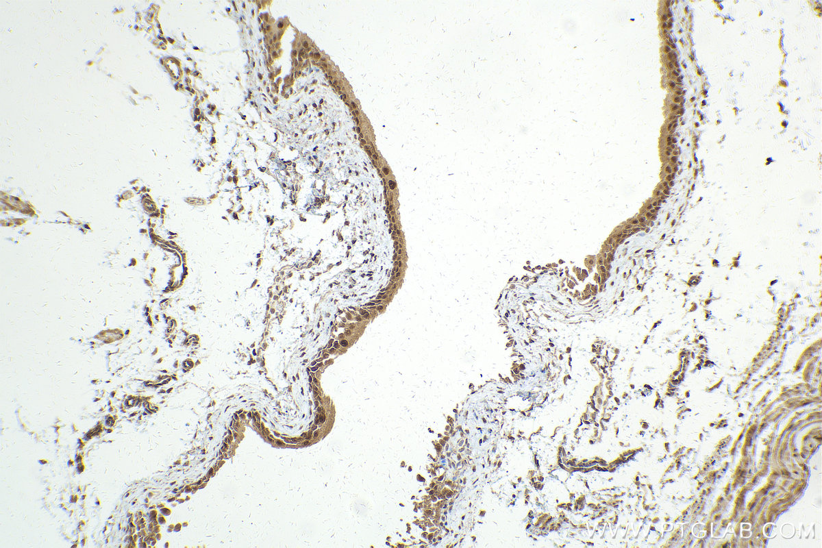 IHC staining of mouse bladder using 10195-1-AP