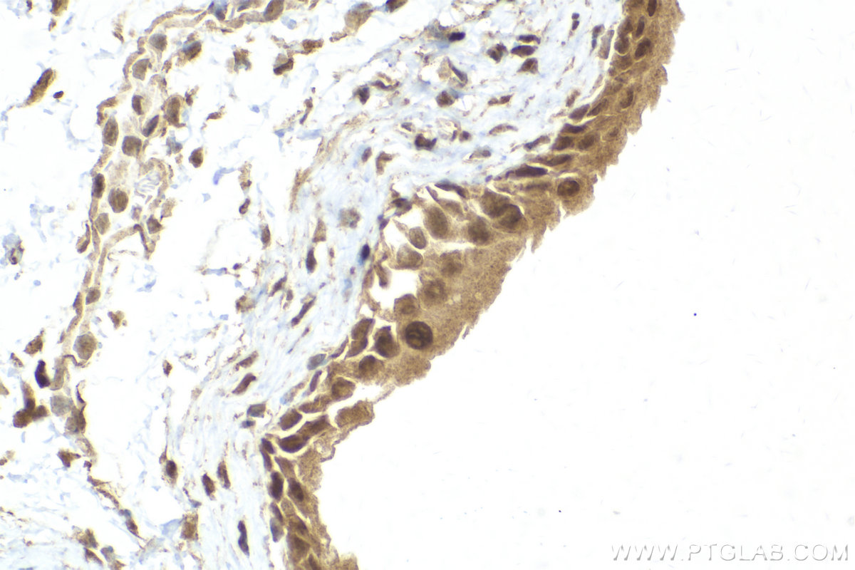 IHC staining of mouse bladder using 10195-1-AP