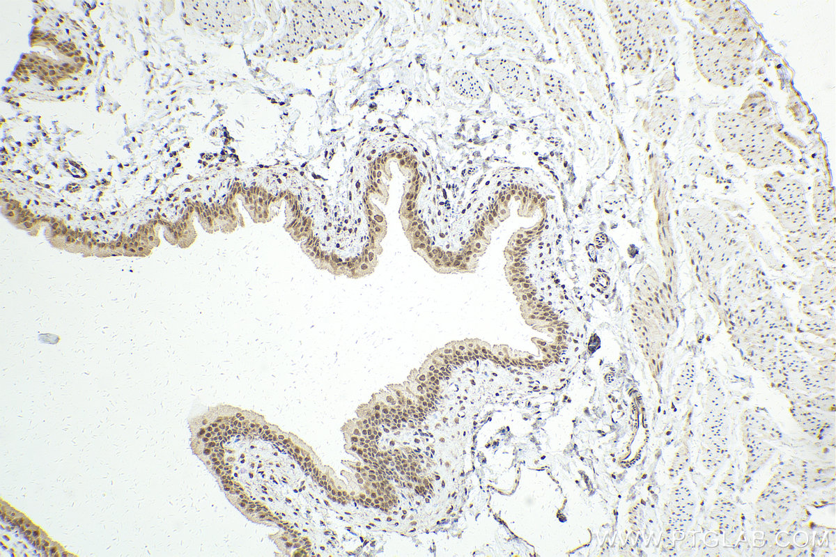 IHC staining of rat bladder using 10195-1-AP