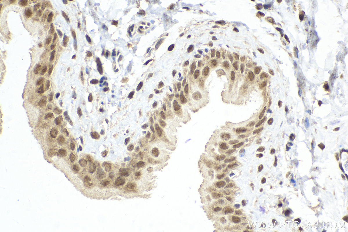 IHC staining of rat bladder using 10195-1-AP