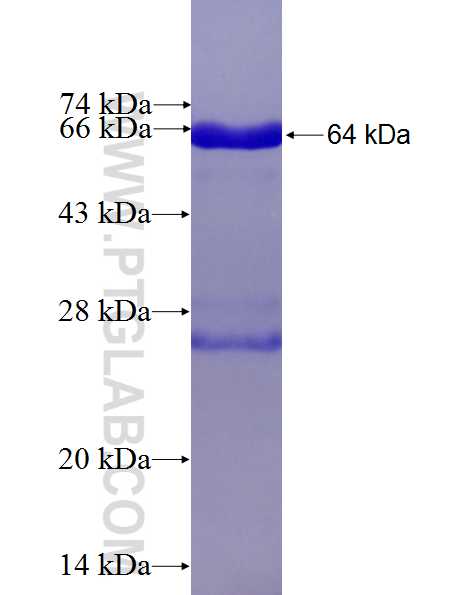 RWDD2B fusion protein Ag27181 SDS-PAGE