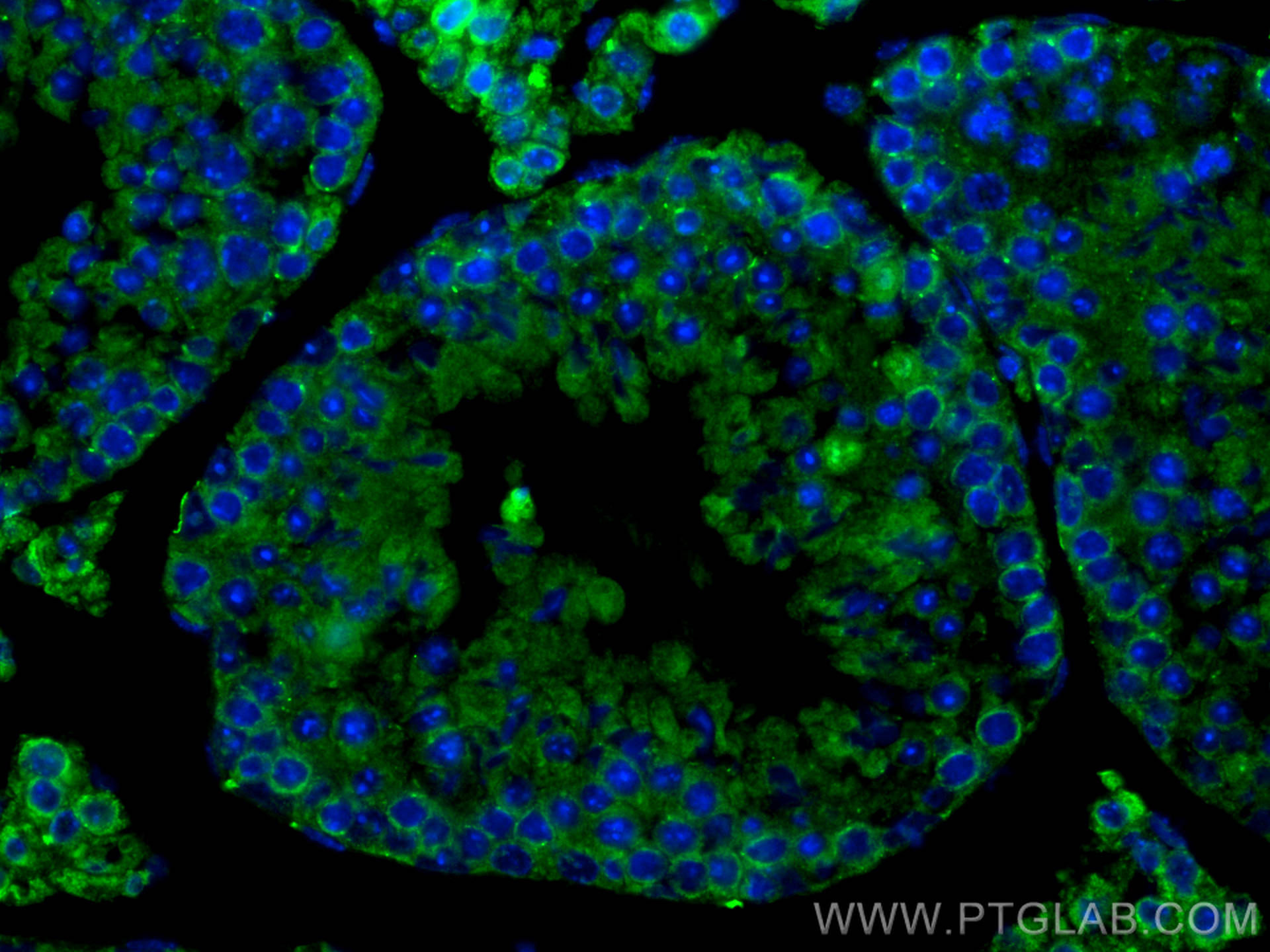 IF Staining of mouse testis using 18419-1-AP