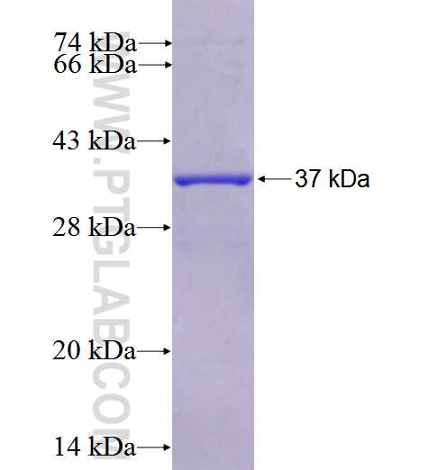 RYR3 fusion protein Ag25978 SDS-PAGE