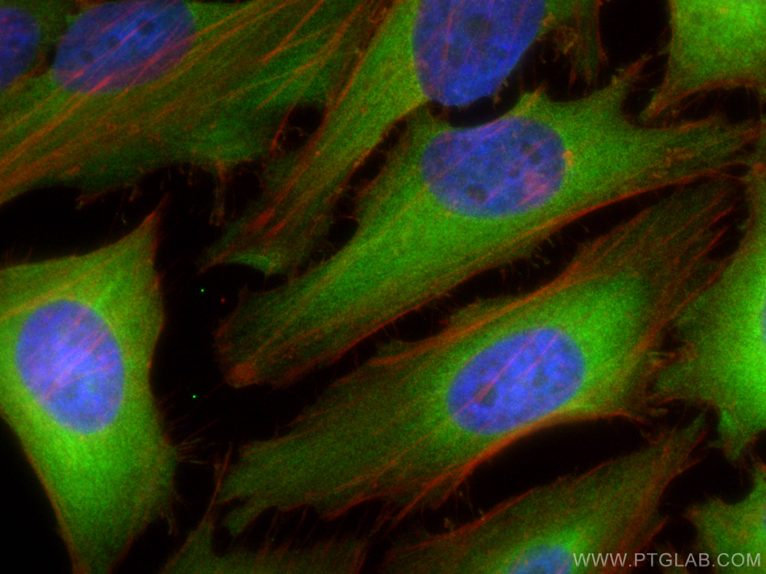 IF Staining of HeLa using 27804-1-AP