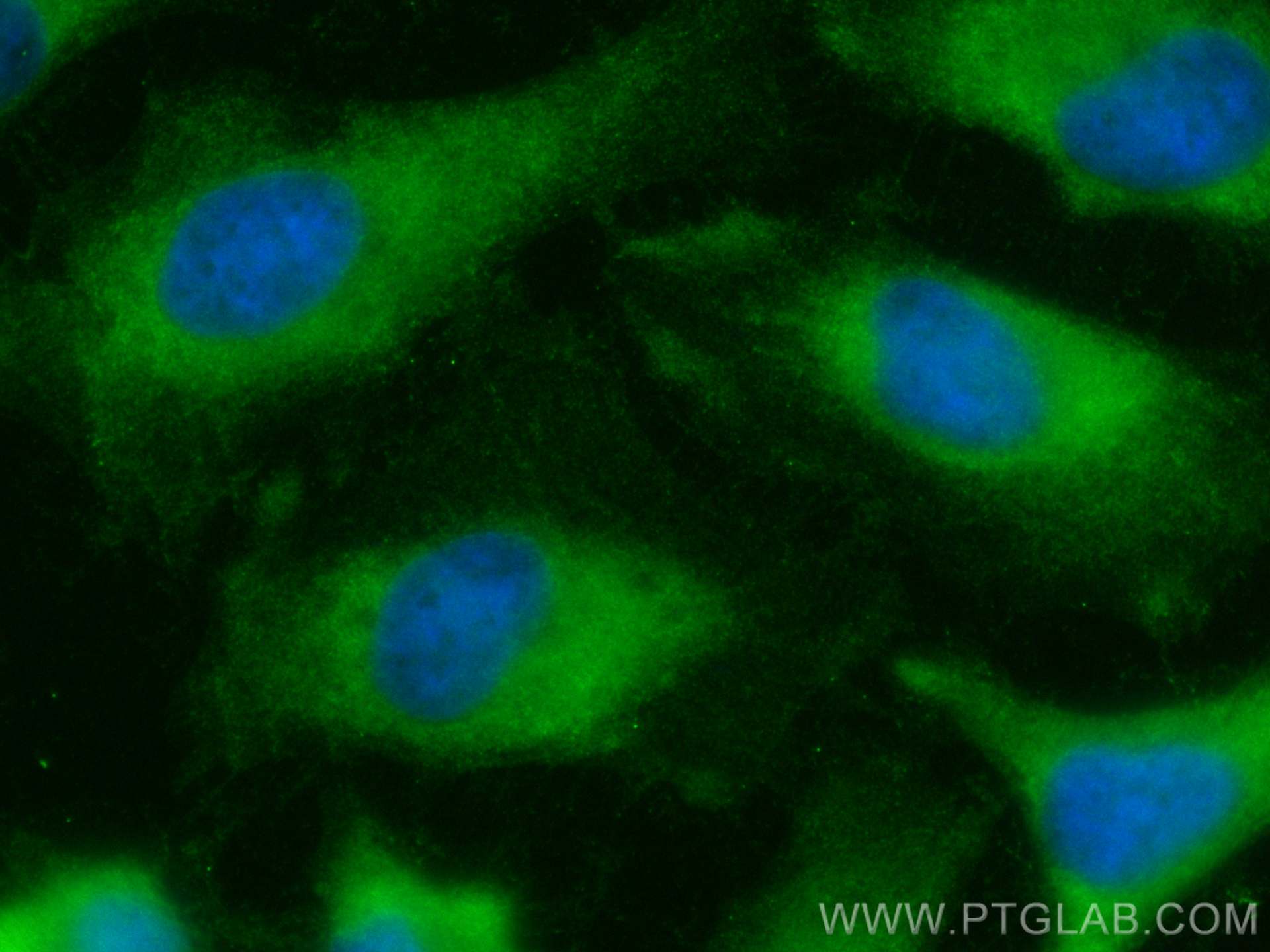 IF Staining of HeLa using CL488-27804