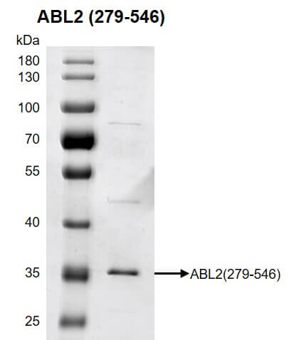 Recombinant ABL2 (279-546) protein gel 10% SDS-PAGE with Coomassie blue staining MW: 32 kDa Purity: >85%