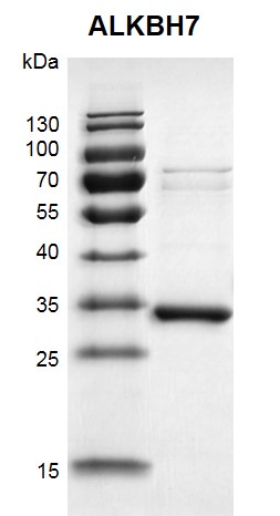 Recombinant ALKBH7 protein gel 12.5% SDS-PAGE Coomassie staining MW: 37.4 kDa Purity: >85%