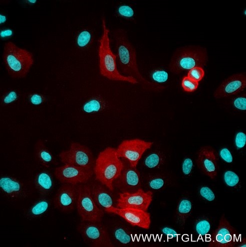 HeLa cells transiently transfected with human CD16 were immunostained with anti-CD16 recombinant VHH, CoraLite® Plus 555 (CL555-CD16, 1:500, red). Nuclei were stained with DAPI (cyan). Epifluorescence images were acquired with a 20x objective and post-processed.
Note: Immunostaining with CL555-CD16 can be performed live or after formaldehyde fixation. HeLa cells transiently transfected with human CD16 were immunostained with anti-CD16 recombinant VHH, CoraLite® Plus 555 (CL555-CD16, 1:500, red). Nuclei were stained with DAPI (cyan). Epifluorescence images were acquired with a 20x objective and post-processed.
Note: Immunostaining with CL555-CD16 can be performed live or after formaldehyde fixation.