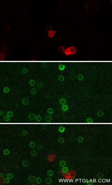 Live human PBMCs were gravity-sedimented and immunostained with anti-CD16 recombinant VHH, CoraLite® Plus 555 (CL555-CD16, red) and anti-CD3 IgG-CL488 (CL488-65151, green). Images were acquired with a 20x objective and post-processed. Dead cells (autofluorescent in all channels including UV and far-red) we subtracted from all channels with ImageJ.
Note: Immunostaining with CL555-CD16 can be performed live or after formaldehyde fixation. Live human PBMCs were gravity-sedimented and immunostained with anti-CD16 recombinant VHH, CoraLite® Plus 555 (CL555-CD16, red) and anti-CD3 IgG-CL488 (CL488-65151, green). Images were acquired with a 20x objective and post-processed. Dead cells (autofluorescent in all channels including UV and far-red) we subtracted from all channels with ImageJ.
Note: Immunostaining with CL555-CD16 can be performed live or after formaldehyde fixation.