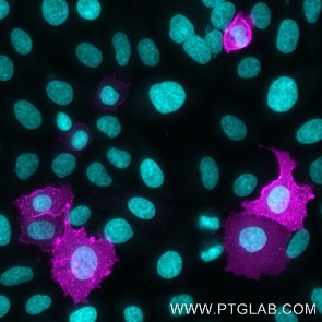 HeLa cells transfected with human Mesothelin were live immunostained with CoraLite Plus 647 conjugated MSLN VHH (1:500, magenta). Nuclei were stained with DAPI (blue or cyan) after cell fixation. Epifluorescence images were acquired with a 20x objective and post-processed. 
Comment: Immunostaining with CoraLite Plus 647 conjugated MSLN VHH can be performed live or after formaldehyde fixation.