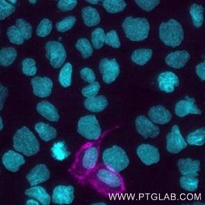 A-431 cells transfected with human Mesothelin were live immunostained with CoraLite Plus 647 conjugated MSLN VHH (1:500, magenta). Nuclei were stained with DAPI (cyan) after cell fixation. Epifluorescence images were acquired with a 20x objective and post-processed. 
Comment: Immunostaining with CoraLite Plus 647 conjugated MSLN VHH can be performed live or after formaldehyde fixation.