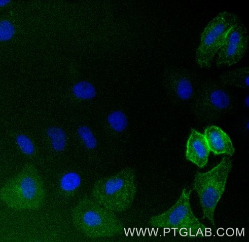 HeLa cells transiently transfected with human CD16 were immunostained with anti-CD16 VHH-FITC (code, 1:500, green). Nuclei were stained with DAPI (blue). Epifluorescence images were acquired with a 20x objective and post-processed.
Note: Immunostaining with anti-CD16-VHH-Dye can be performed live or after formaldehyde fixation. HeLa cells transiently transfected with human CD16 were immunostained with anti-CD16 VHH-FITC (code, 1:500, green). Nuclei were stained with DAPI (blue). Epifluorescence images were acquired with a 20x objective and post-processed.
Note: Immunostaining with anti-CD16-VHH-Dye can be performed live or after formaldehyde fixation.