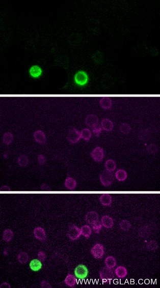 Live human PBMCs were gravity-sedimented and immunostained with anti-CD16 recombinant VHH, FITC Plus (FITC-CD16, green) and anti-CD3 IgG-CL555 (CL555-65151, magenta). Images were acquired with a 20x objective and post-processed. Dead cells (autofluorescent in all channels including UV and far-red) we subtracted from all channels with ImageJ.
Note: Immunostaining with FITC-CD16 can be performed live or after formaldehyde fixation. Live human PBMCs were gravity-sedimented and immunostained with anti-CD16 recombinant VHH, FITC Plus (FITC-CD16, green) and anti-CD3 IgG-CL555 (CL555-65151, magenta). Images were acquired with a 20x objective and post-processed. Dead cells (autofluorescent in all channels including UV and far-red) we subtracted from all channels with ImageJ.
Note: Immunostaining with FITC-CD16 can be performed live or after formaldehyde fixation.