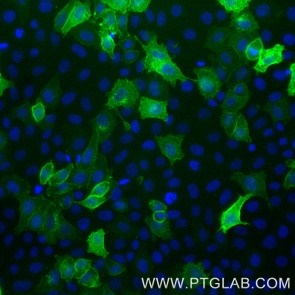Live HeLa cells transfected with human TIM-3 were immunostained with FITC Plus-conjugated TIM3 VHH (FITC-tmt,1:1000, green). Cells were fixed and nuclei were stained with DAPI (blue). Epifluorescence images were acquired with 20x objective and post-processed. 
Note: Immunostaining with FITC-tmt can also be performed after formaldehyde fixation of the cells.