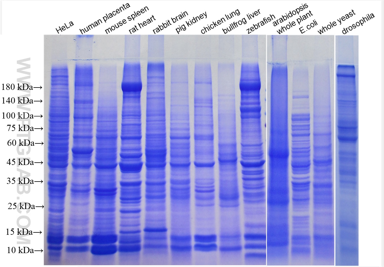 SDS-PAGE胶 考马斯亮蓝染色图。胶浓度：8-18%梯度胶；上样量:30 ug。
