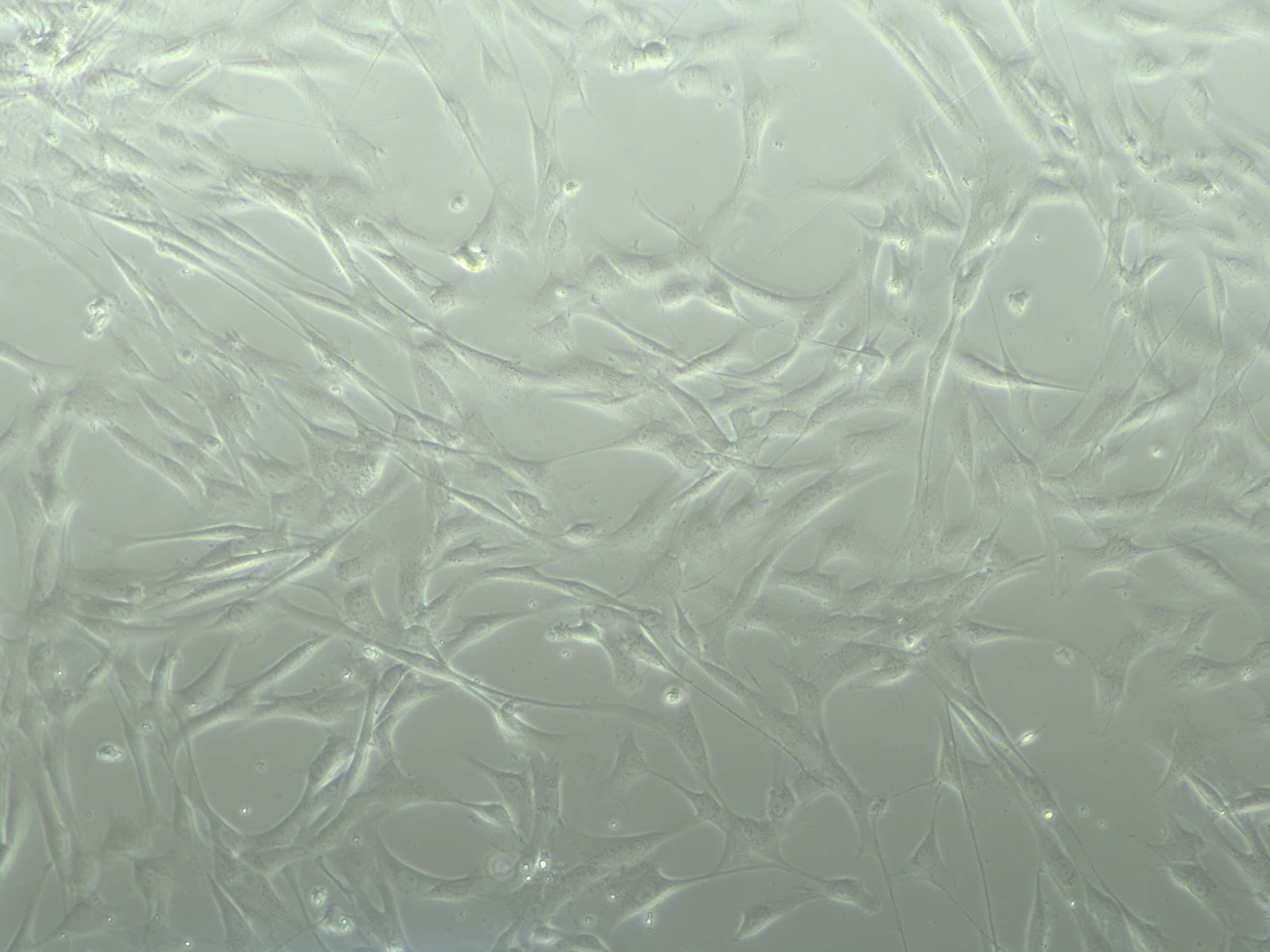 此图为人间充质干细胞（hMSCs）以Proteintech特级胎牛血清配制完全培养基培养后所摄细胞形态图片。