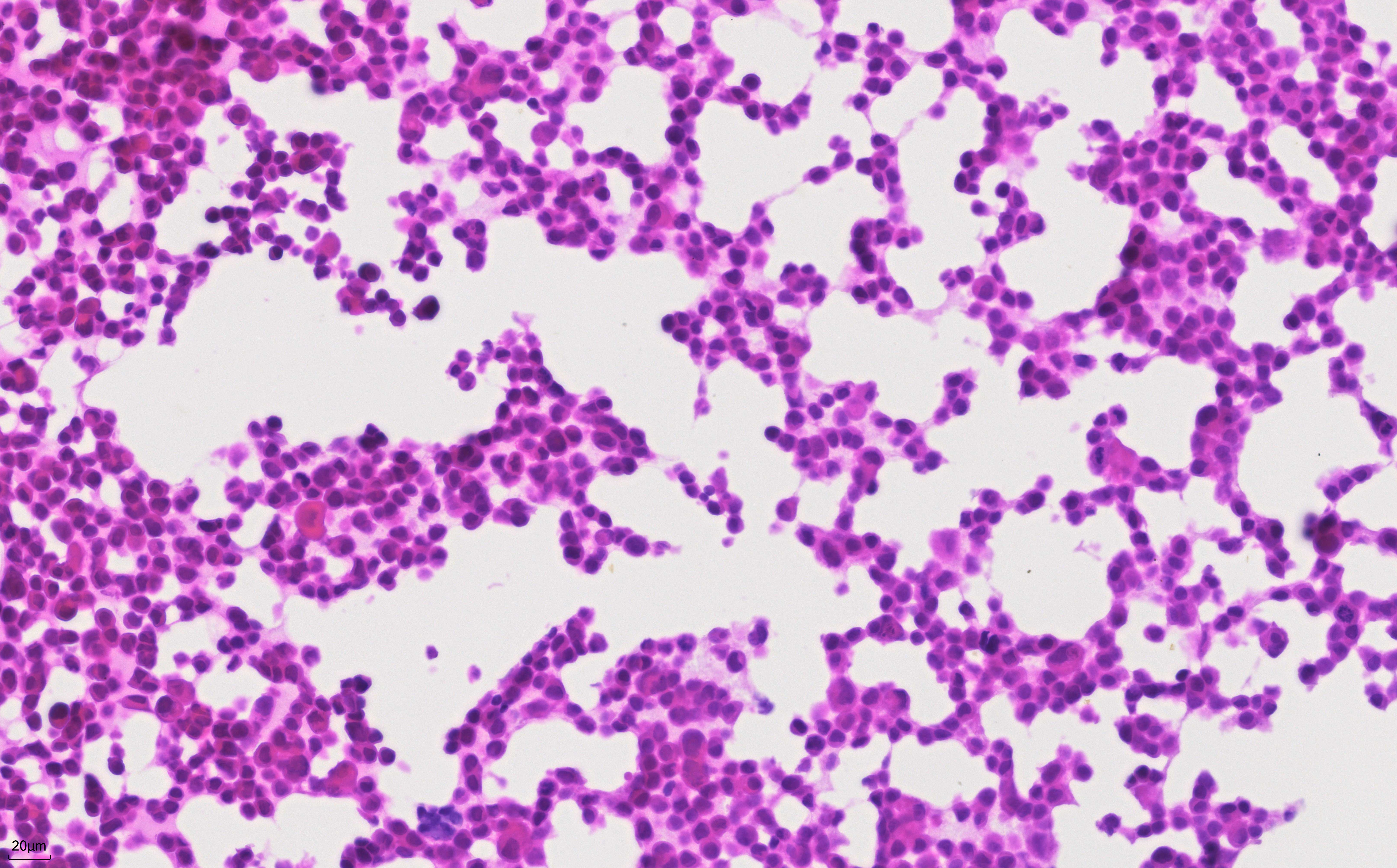 FFPE MCF-7 cell line was stained with PR30004 (Mayer's Hematoxylin Solution) and PR30019 (Eosin Staining Solution).
