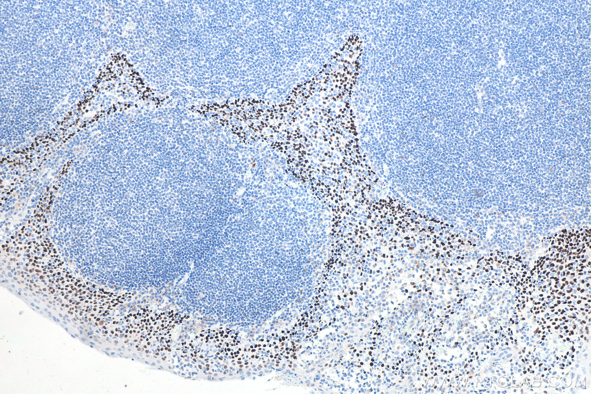 Immunohistochemical analysis of paraffin-embedded human tonsillitis tissue slide using 60332-2-Ig (TP63 antibody). PR30004 (Mayer's Hematoxylin) was used for counter staining