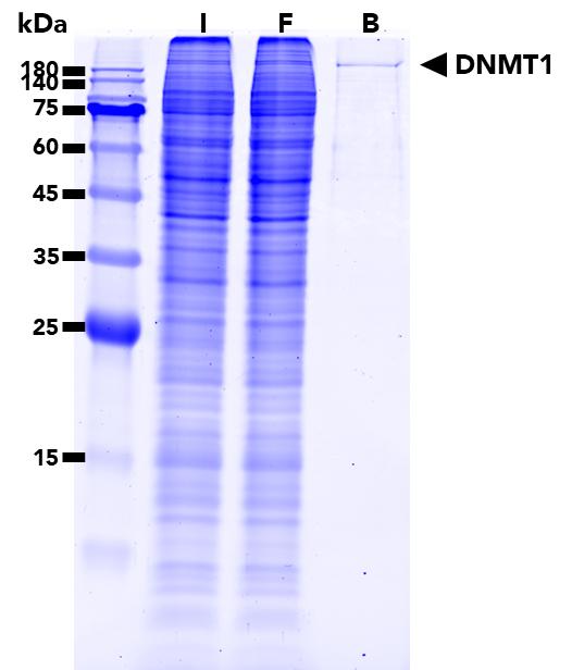The DNMT1-Trap Agarose was used to immunoprecipiate endogenous DNMT1 protein from HEK293T cells. Input (I), Flow-Through (FT), Bound B).