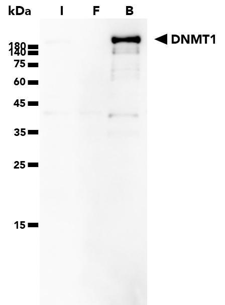 IP of endogenous DNMT1 protein from HEK293T cells using DNMT-1 Trap Agarose followed by western blot using  DNMT1 Polyclonal Antibody (24206-1-AP) and Multi-rAb HRP-Goat Anti-Rabbit Recombinant Secondary Antibody (RGAR001). Samples from the Input (I), Flow-Through (F), and Bound (B) fractions were used in the western blot analysis.