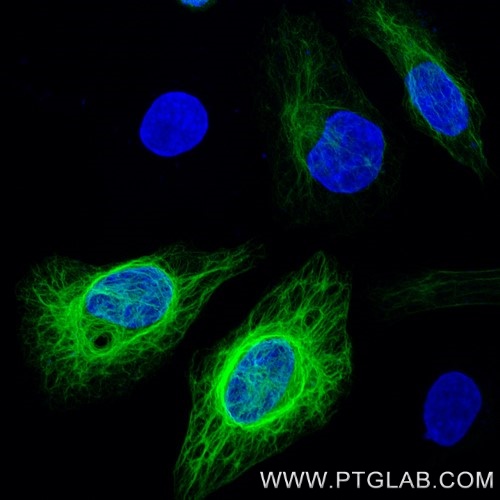 Immunofluorescence with anti-HA-Label, CoraLite ® Plus 488 (hbCL488, 1:500, green) visualizes HA-tagged Vimentin, transiently expressed in HeLa cells. Nuclei are stained with DAPI (blue). Confocal images were were acquired with a 63x oil objective and post-processed.