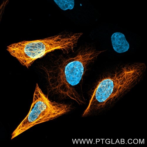 Immunofluorescence with anti-HA-Label, CoraLite ® Plus 555 (hbCL555, 1:500, orange) visualizes HA-tagged Vimentin, transiently expressed in HeLa cells. Nuclei are stained with DAPI (cyan). Confocal images were were acquired with a 63x oil objective and post-processed.