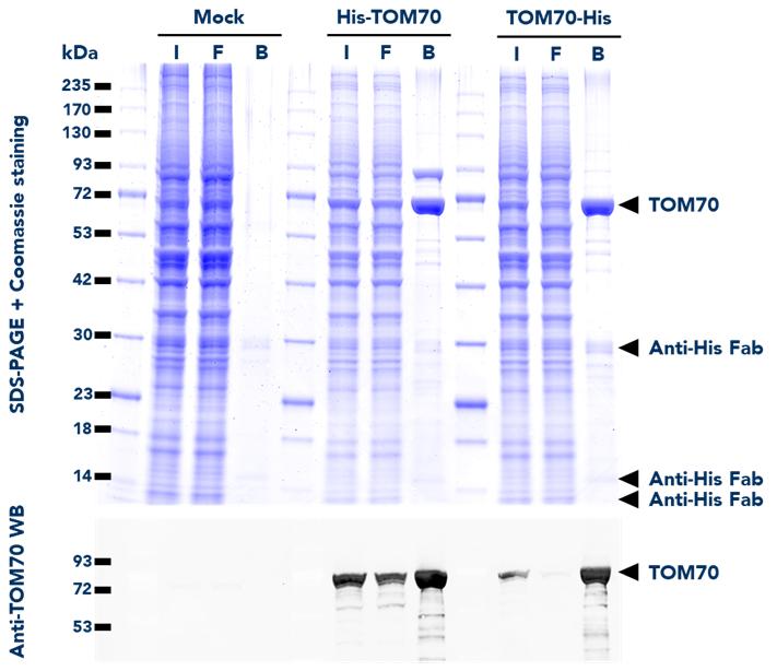 IP using His Fab-Trap® Agarose (hfa) from untransfected HEK293T (mock) and HEK293T cells transfected with either His-TOM70 or TOM70-His fusion proteins. WB detection of TOM70 protein was also done on samples from the Input (I), Flow-Through (F), and Bound (B) fractions using Anti-TOM70 Polyclonal Antibody (14528-1-AP) and ChromoTek Nano-Secondary alpaca anti-rabbit IgG, CoraLite Plus 488 (srb2GCL488-1).