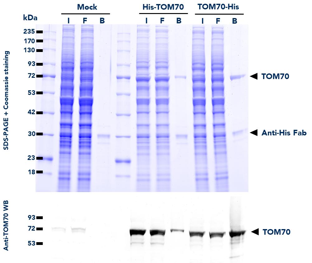 IP using His Fab-Trap® Magnetic Particles M-270 (hfd) from untransfected HEK293T (mock) and HEK293T cells transfected with either His-TOM70 or TOM70-His fusion proteins. WB detection of TOM70 protein was also done on samples from the Input (I), Flow-Through (F), and Bound (B) fractions using Anti-TOM70 Polyclonal Antibody (14528-1-AP) and ChromoTek Nano-Secondary alpaca anti-rabbit IgG, CoraLite Plus 488 (srb2GCL488-1).