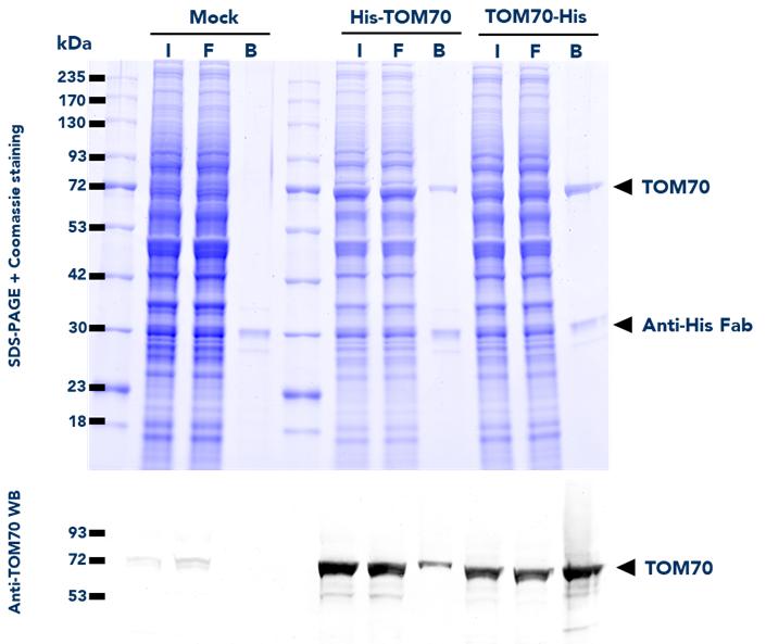 IP using His Fab-Trap® Magnetic Particles M-270 (hfd) from untransfected HEK293T (mock) and HEK293T cells transfected with either His-TOM70 or TOM70-His fusion proteins. WB detection of TOM70 protein was also done on samples from the Input (I), Flow-Through (F), and Bound (B) fractions using Anti-TOM70 Polyclonal Antibody (14528-1-AP) and ChromoTek Nano-Secondary alpaca anti-rabbit IgG, CoraLite Plus 488 (srb2GCL488-1).