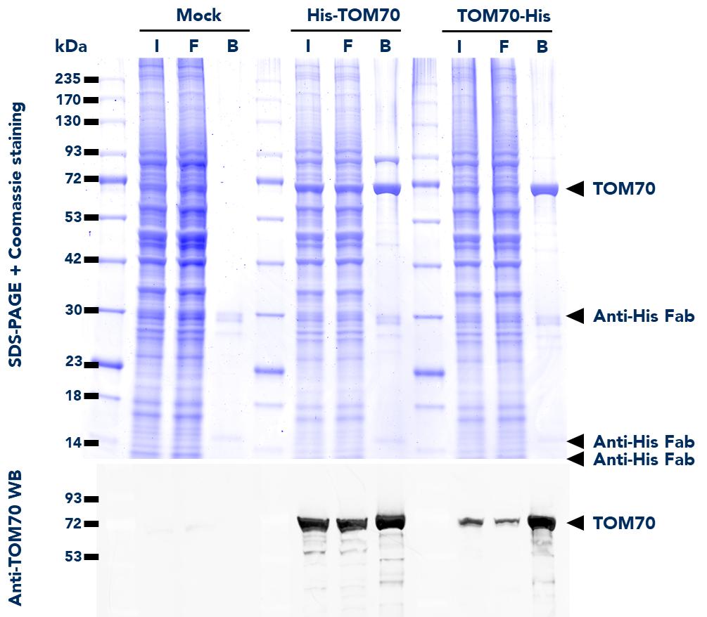 IP using His Fab-Trap® Magnetic Agarose (hfma) from untransfected HEK293T (mock) and HEK293T cells transfected with either His-TOM70 or TOM70-His fusion proteins. WB detection of TOM70 protein was also done on samples from the Input (I), Flow-Through (F), and Bound (B) fractions using Anti-TOM70 Polyclonal Antibody (14528-1-AP) and ChromoTek Nano-Secondary alpaca anti-rabbit IgG, CoraLite Plus 488 (srb2GCL488-1).